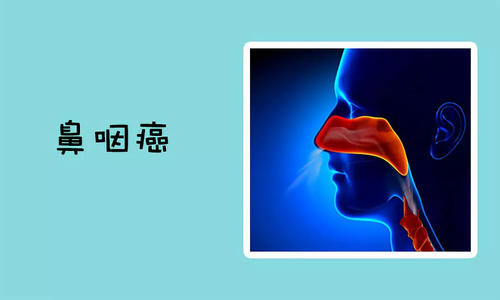 福州中医辨证看鼻咽癌